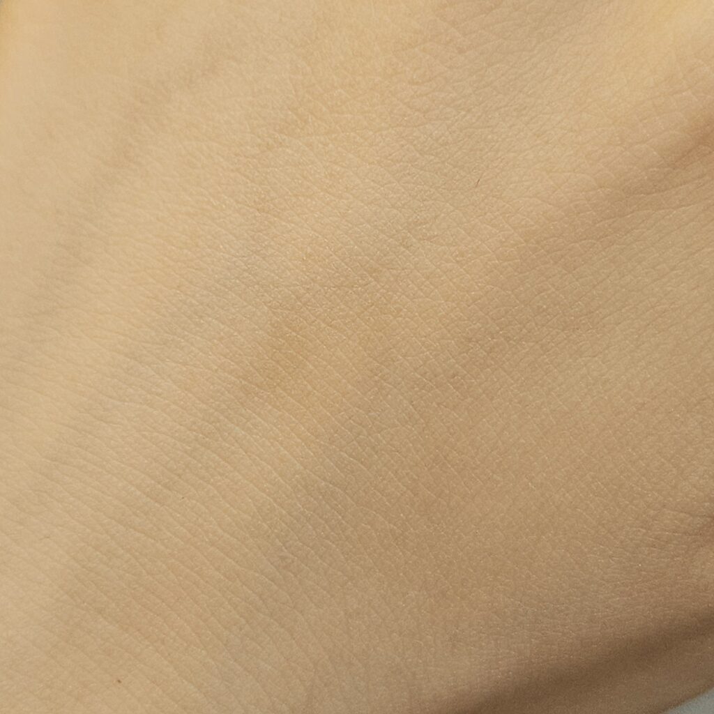 約3ヶ月のThe Ordinaryケアで色素沈着が薄くなった手の甲の写真